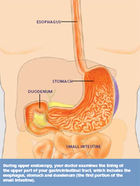 Understanding Upper Endoscopy